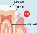 知覚過敏.jpg